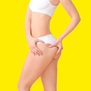 Risultati di riduzione della cellulite con VACUFIT su fianchi, cosce, pancia e glutei.